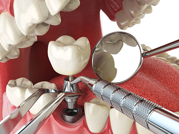 Best Emergency Treatment for Toothache in Livingston, TN